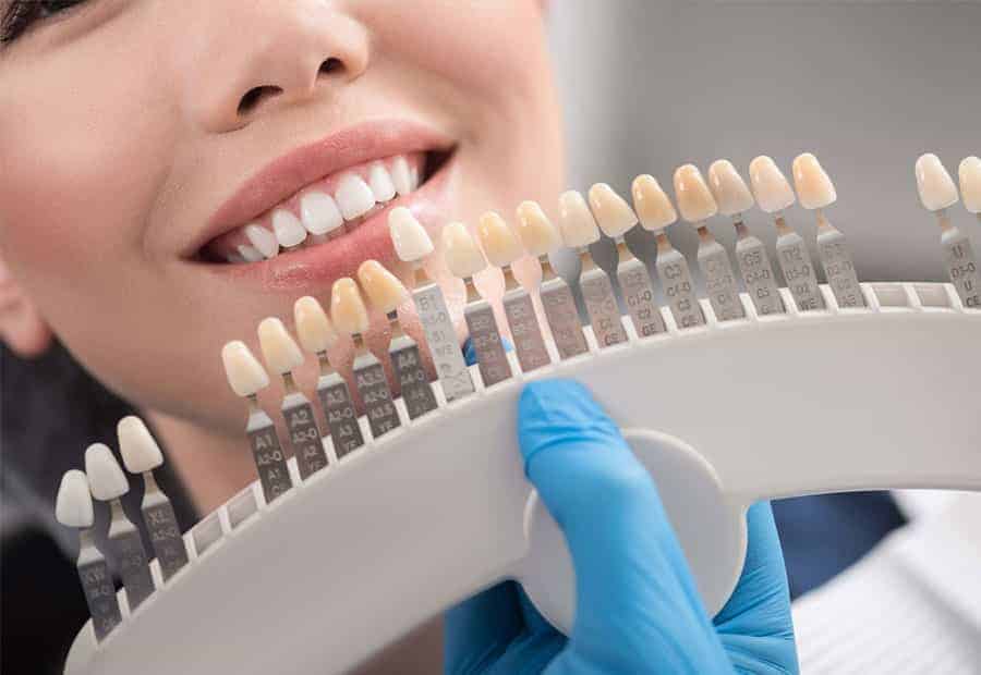 Porselen laminalar; diş rengi, şekli ve boyutunu estetik olarak düzeltme yöntemidir