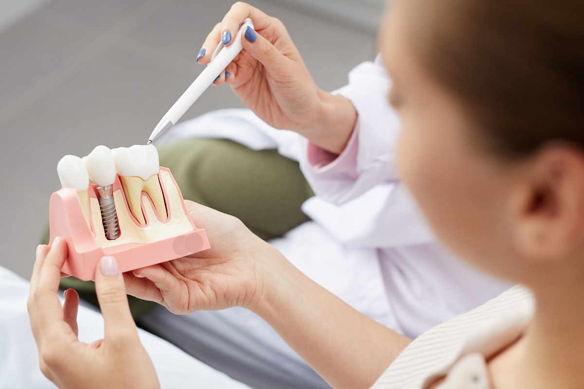 implant titanyum vida diş tedavisi