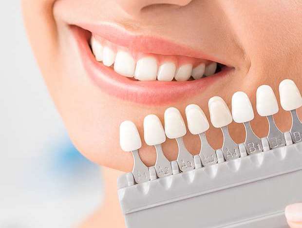 Porselen Laminalar (Yaprak Porselen)