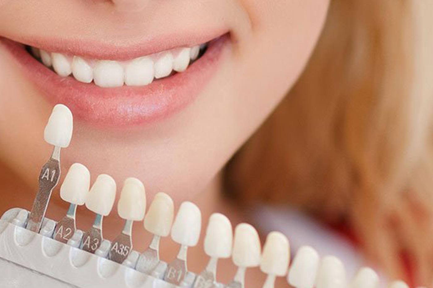 Konservatif Diş Tedavisi